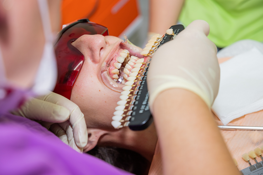 Enhance Your Smile with Veneers