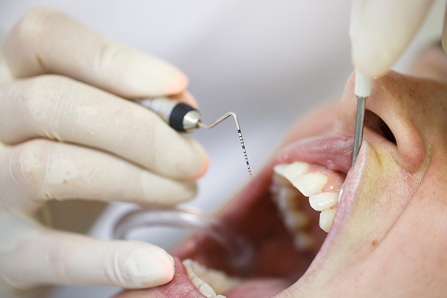 Understanding Periodontal Disease: Causes, Symptoms, and Treatment Options